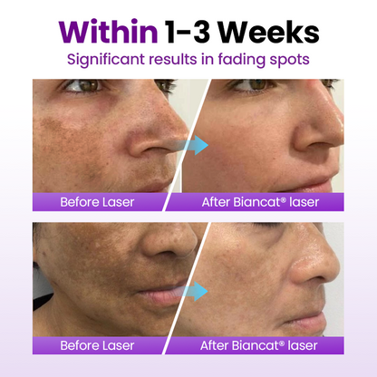 Ptyalial® SpotErase Probiotic Shield Serum