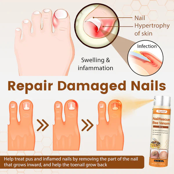 Ptyalial® NailRescue Bee Venom Spray