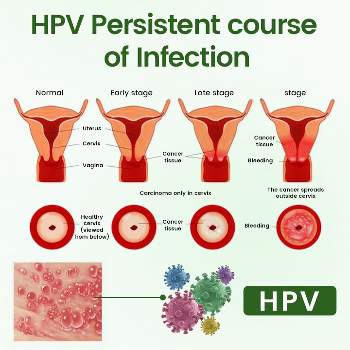 Ptyalial™ FeminaDefend All-In-One Intimate Therapy Pads